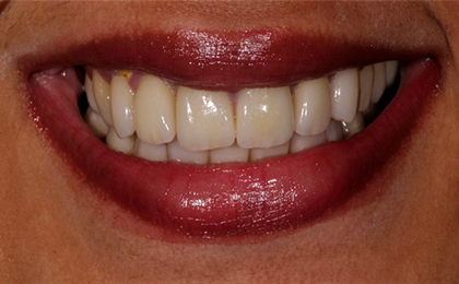 Tiny Pearls Dental Care - Post - Operative