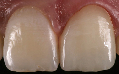 Tiny Pearls Dental Care - Post - Operative