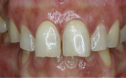 Tiny Pearls Dental Care - Pre - Operative