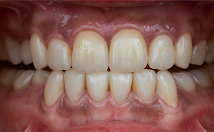 Tiny Pearls Dental Care - Post - Operative