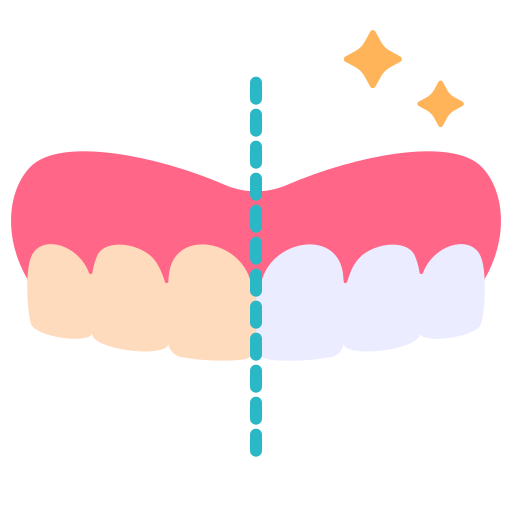 tooth whitening 1